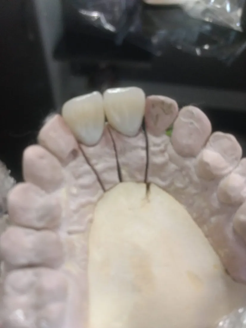Duas peças de porcelana sobre o modelo