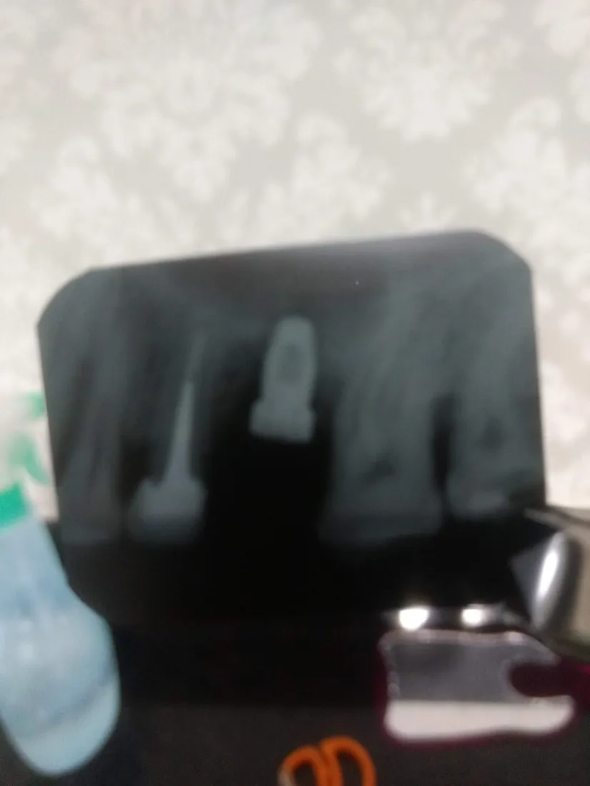 Radiografia de dente com tratamento de canal